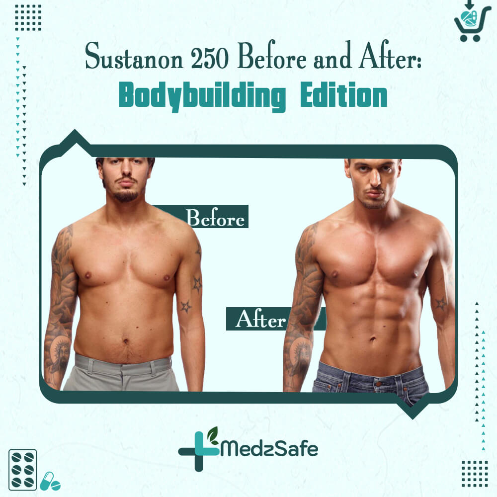 Sustanon 250 Before and After: Bodybuilding Edition
